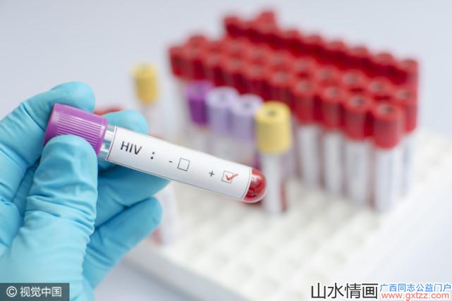 艾滋病也有可能终身不发病，HIV也许并不如想象中的可怕