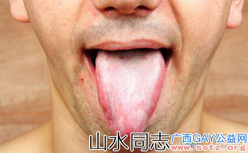 防艾：舌头症状是如果是这样，请注意艾滋病